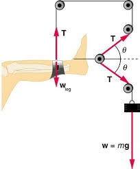 4 6 Normal Tension And Other Examples