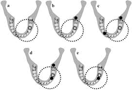 cone beam ct optimisation for detection