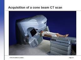 image guided radiation therapy