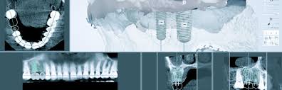 cone beam dental ct scan cbct cone