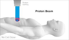 why proton therapy mevion cal systems