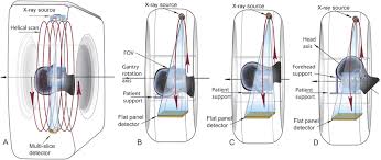 multislice ct msct