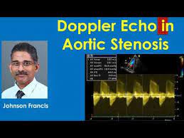 Doppler Echocardiography In Aortic