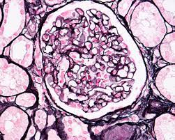 Kidney Glomerulus Basement Membranes