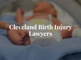 Cleveland Birth Injury Attorney Free