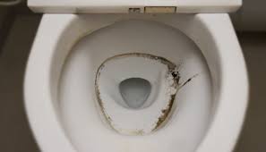 Mold In Toilet How To Remove Mold In