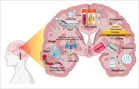 Traumatic Brain Injury Tbi