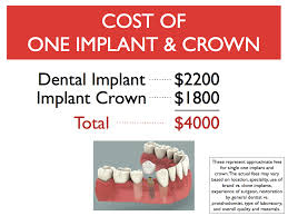 dental bridge and dental implant