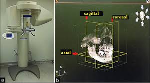 galileos cone beam computed tomography