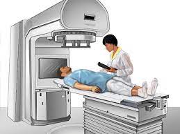 external beam radiation therapy for