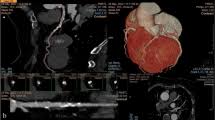 coronary artery ct calcium score