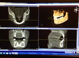 new cone beam ct brings 3 d views to