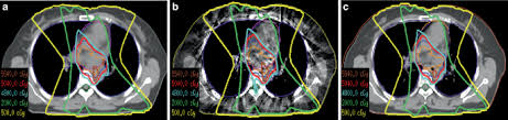 improving cbct image quality to the ct
