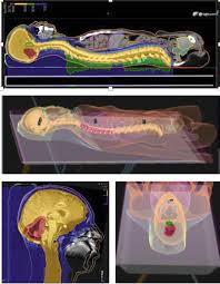 proton cancer therapy synchrotron