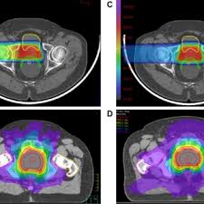 pdf proton beam therapy clinical