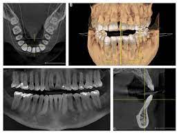 3d x rays westmount dental arts