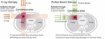 proton beam tsuyama chuo hospital