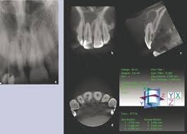 cone beam ct in dental practice