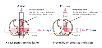 what is proton therapy aizawa hospital