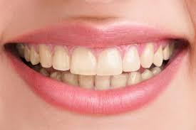 teeth whitening cosmetic dentistry