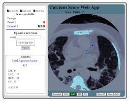 coronary artery calcium