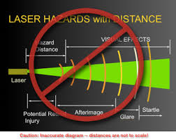 basic principles of laser beam hazards
