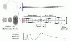 ultrasound radiology key