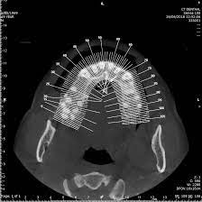 cone beam ct dental radiologie dr