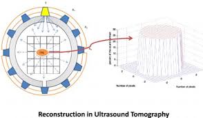 Ultrasound Tomography