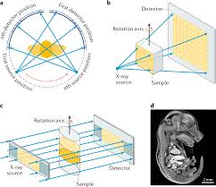 x ray computed tomography nature