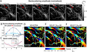 2d ulm backtering imaging and 3d
