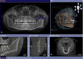 3d imaging nikodem dental