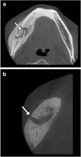 cone beam ct of the musculoskeletal