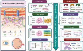 Pathogenesis Of Common Ocular Diseases