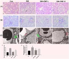 Full Article The Kidney Antifibrotic