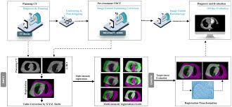 multi intensity optimization based ct