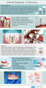 dental implants vs dentures cosmetic