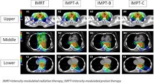 intensity modulated proton therapy