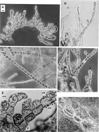 Rhizoclonium An Overview