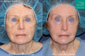 anti aging skin procedures san go