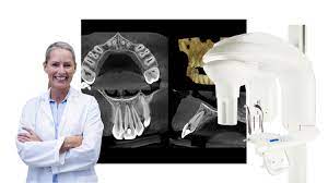 when ing a dental cone beam system