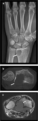 cone beam ct of the musculoskeletal