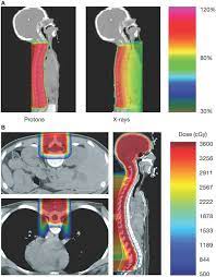 treatment in pediatric brain tumors