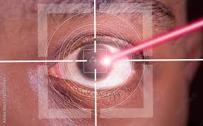 laser or lasik eye surgery concept l