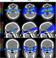 treatment of pituitary adenoma