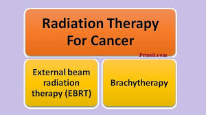 radiation therapy for cancer ebrt