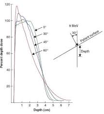 electron therapy physics oncology