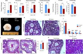 The Pcos Nafld Multidisease Phenotype