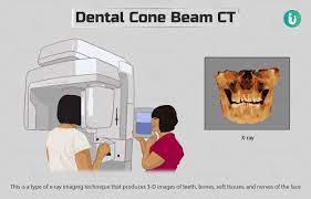 dental cone beam ct procedure purpose