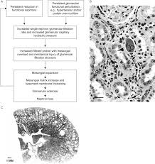 Glomerular Capillary An Overview